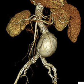 非血管系のイメージ画像
